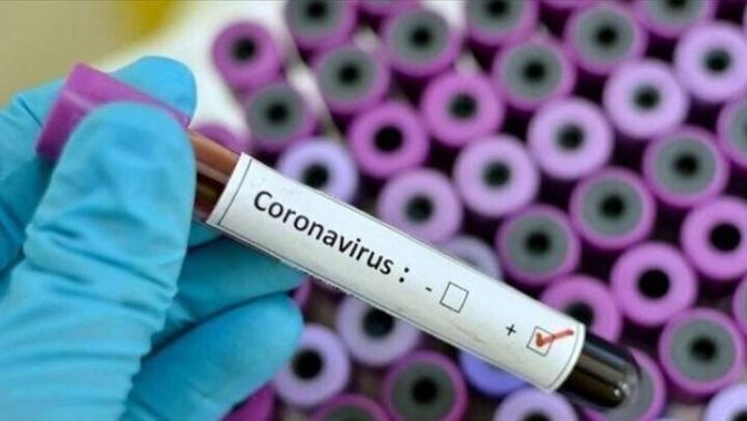 İran Savunma Bakanlığı, ürettiği koronavirüs teşhis kitini tanıttı