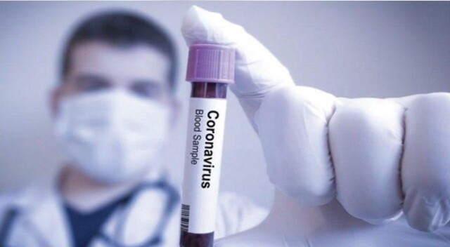 Japonya koronavirüse karşı Ebola ilacını deneyecek