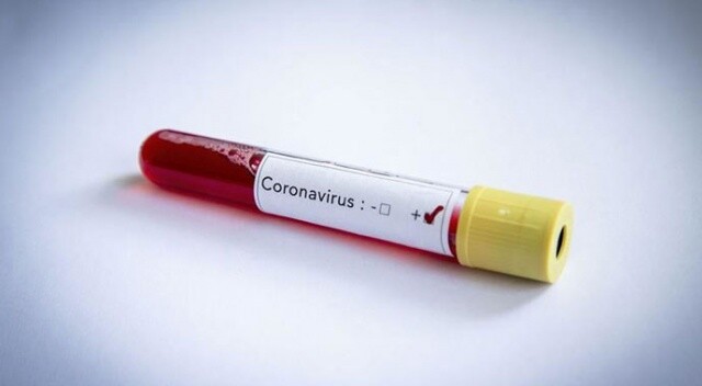 Kanada&#039;da koronavirüsten ölenlerin sayısı 19’a yükseldi