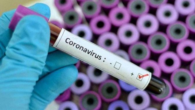 Koronavirüse 150 çözüm önerisi