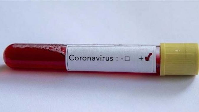 Libya&#039;da ilk koronavirüs vakası tespit edildi