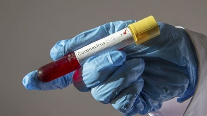 Suudi Arabistan&#039;da koronavirüs vaka sayısı 62&#039;ye yükseldi