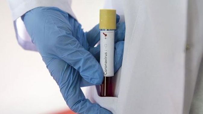 Suudi Arabistan&#039;da yeni tip koronavirüs kaynaklı ilk ölüm gerçekleşti