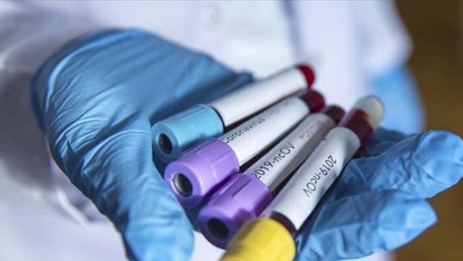 Azerbaycan’da 41 kişide daha koronavirüs tespit edildi
