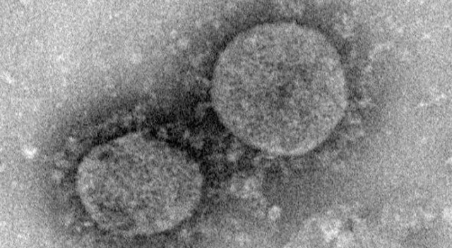 ABD’de koronavirüsten sonra yeni kabus! Hızla yayılıyor