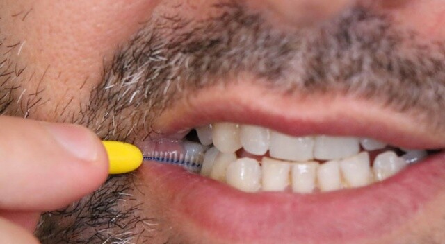 Diş hekimlerinde işler yüzde 50’den fazla düştü