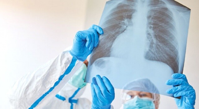 Belirtisiz hastaların akciğeri tehlikede!