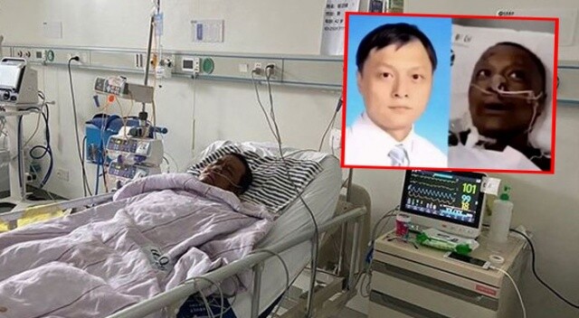 Korona nedeniyle ten rengi değişen Çinli doktor hayatını kaybetti