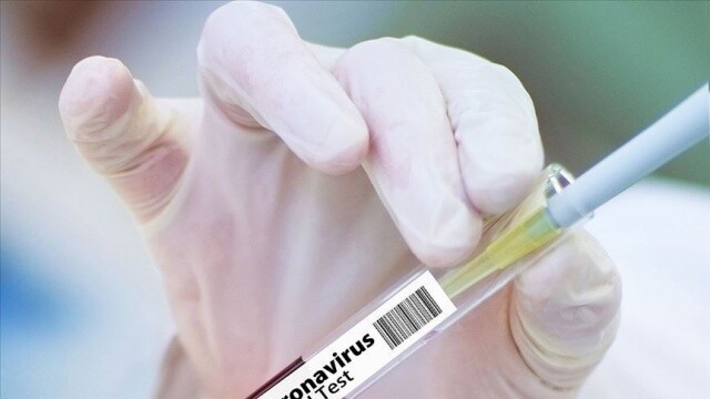 Oxford Üniversitesinin deneyi başarılı olursa Brezilya 100 milyon doz Covid-19 aşısı alacak
