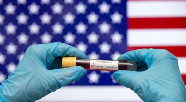 ABD ile Moderna arasında 100.000.000 dozluk aşı anlaşması