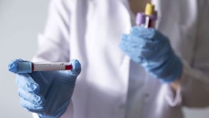 Azerbaycan&#039;da son 24 saatte 226 yeni koronavirüs vakası tespit edildi