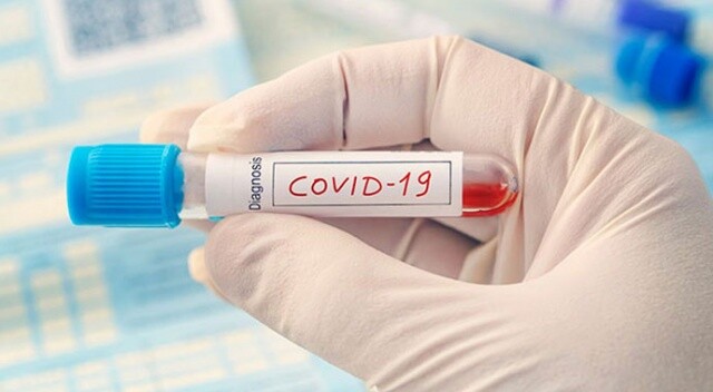 Covid-19&#039;dan ölen genç doktorun babası virüsü yendi
