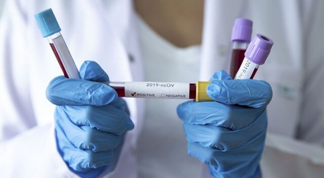 Belçika’da koronavirüsünden hayatını kaybedenlerin sayısı 10 bini aştı