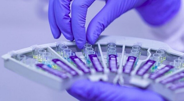 DSÖ: “Başarılı bir aşının yaygın kullanımına kadar Covid-19 ölümleri 2 milyona ulaşabilir”