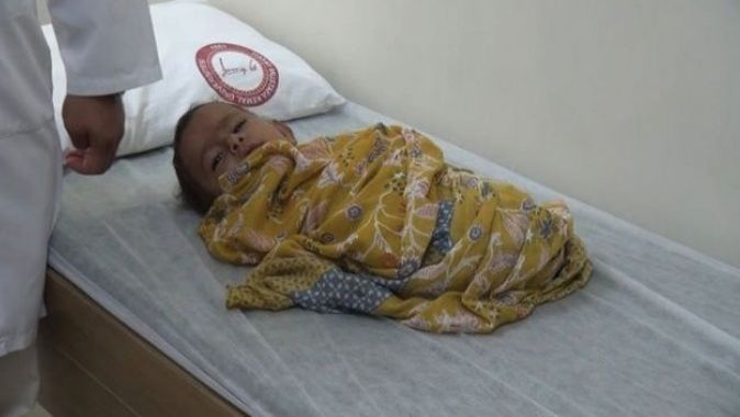 Uzuvları olmayan İdlibli bebek Türkiye’de tedavi altına alındı