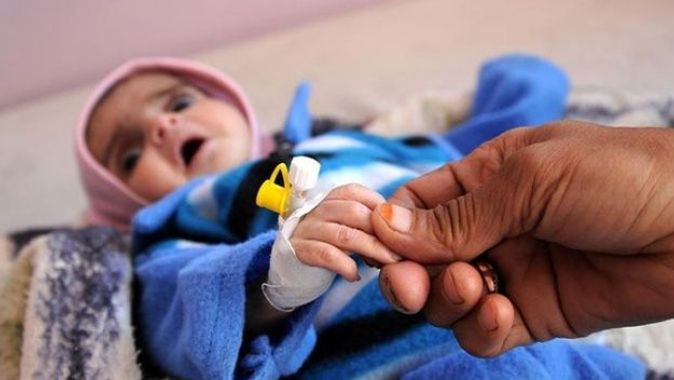 UNICEF&#039;ten Yemen&#039;e çocuk felci aşısı
