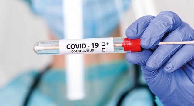 Azerbaycan&#039;da son 24 saatte 4267 yeni koronavirüs vakası tespit edildi