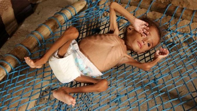 BM&#039;den acı rapor: 13,5 milyon kişi açlıktan ölebilir