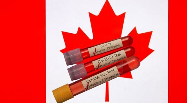 Kanada’da geliştirilen Kovid-19 aşısının klinik testlerine başlandı