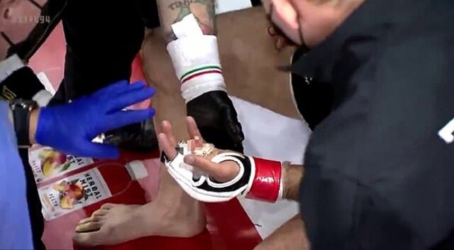 Karma dövüş sporcusunun maç sırasında parmağı koptu