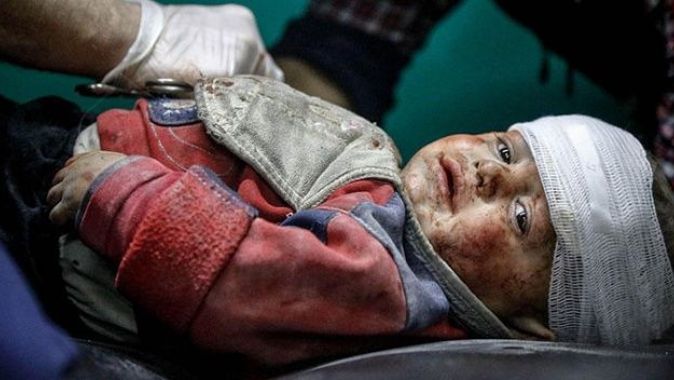 Suriye&#039;de yaralanan çocuklar Türkiye&#039;de tedavi ediliyor