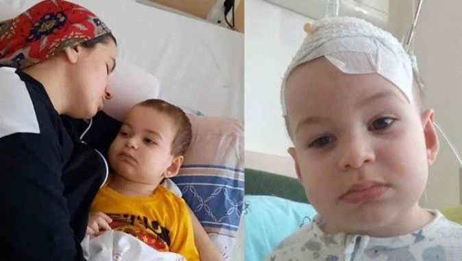 3 yaşındaki çocuğunun başında tümör çıkan annenin yardım çığlıkları