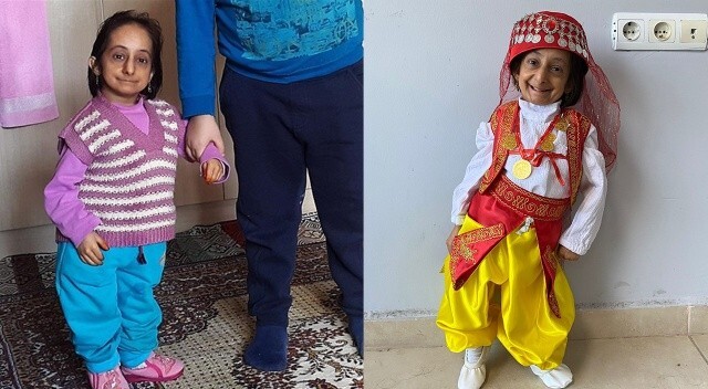 Türkiye&#039;nin en kısa boylu kadını hayatını kaybetti