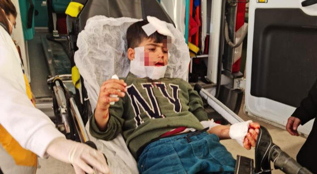 Mardin’de köpeklerin saldırısına uğrayan çocuk ağır yaralandı: Hayati tehlikesi var