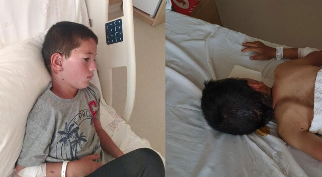 Ankara’da 8 yaşındaki çocuk köpeklerin saldırısına uğradı