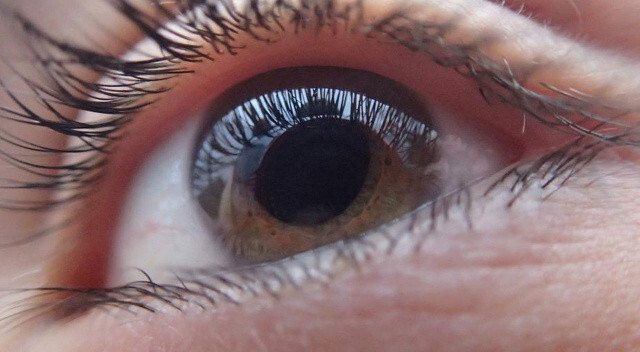 Körlüğe götüren sinsi hastalık! Göz tansiyonu körlüğe yol açabilir
