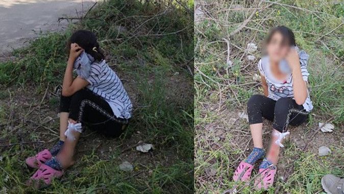 Mersin&#039;de sokak köpeklerinin saldırdığı küçük kız yaralandı