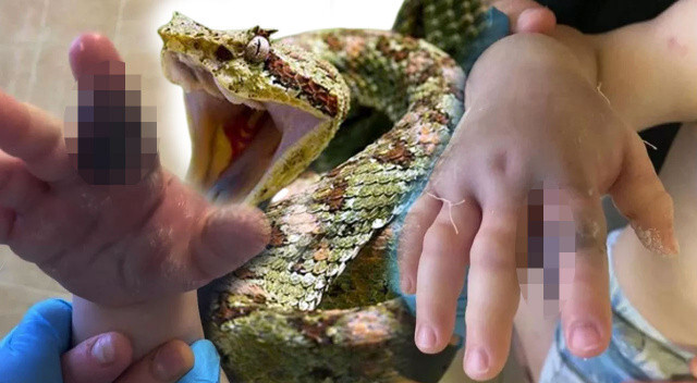 1 yaşındaki çocuğu engerek yılanı ısırdı, annesi elini görünce şoku yaşadı