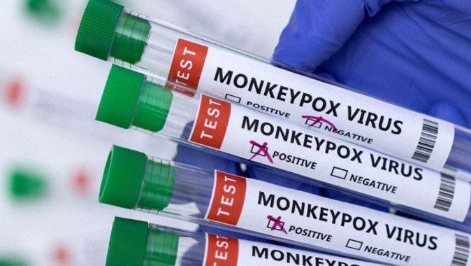 Maymun çiçeği virüsü Türkiye’de! 7 SORU 7 CEVAP: Hastalık hakkında ne biliyoruz?