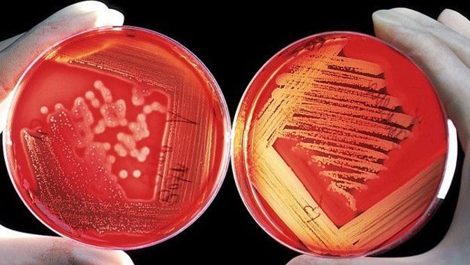Klinikte bakteri kabusu: Kontrolden çıktı bir hafta içinde 6 kişiyi öldürdü
