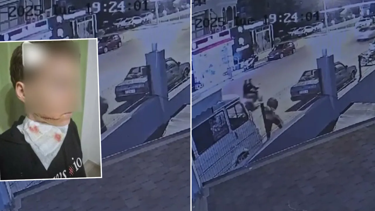 Antalya'da sokak ortasında inanılmaz olay! Genç kadına yumruk atıp, yüzünü kesti