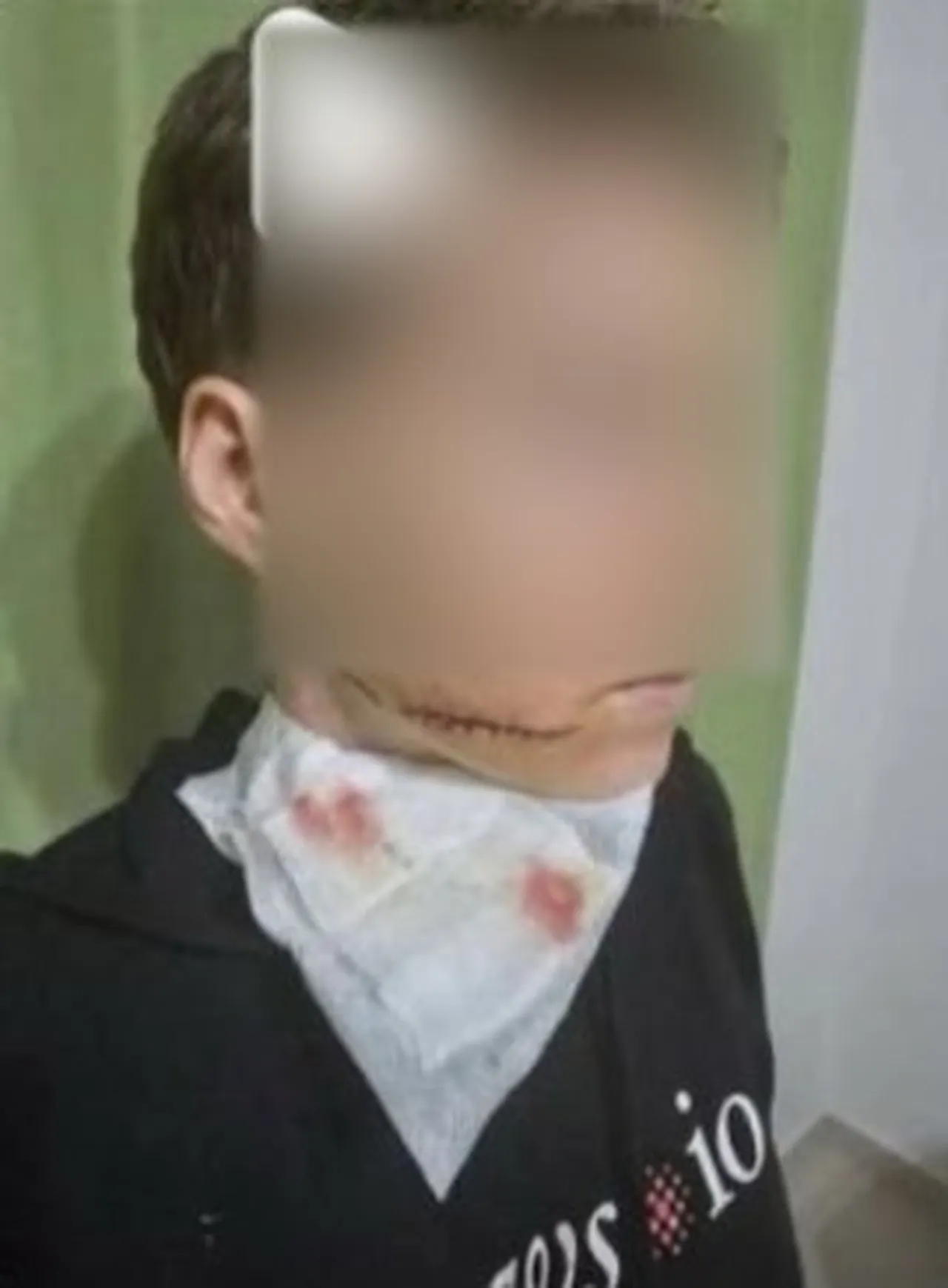 Saldırıya uğrayan kadın