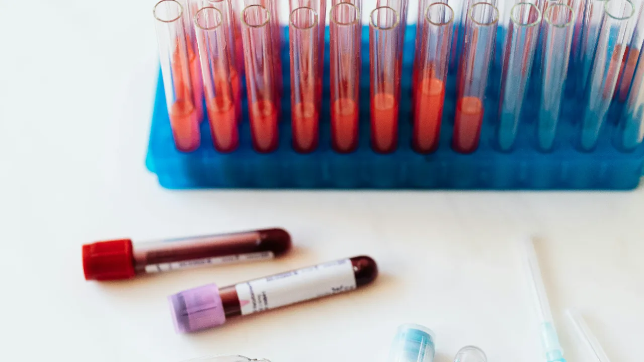 'ALTIN KAN'IN SIRRI ÇÖZÜLÜYOR