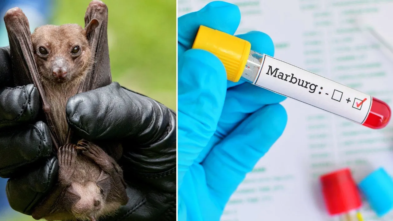 Dokuz vaka peş peşe geldi: Marburg virüsünün tedavisi yok, ölüm oranı %88!