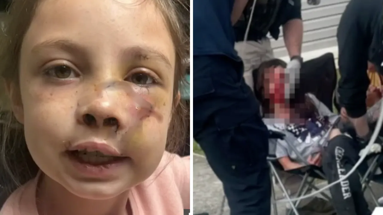 ABD'de korkunç köpek saldırısı! Yüzü parçalandı: Çığlık bile atamadı