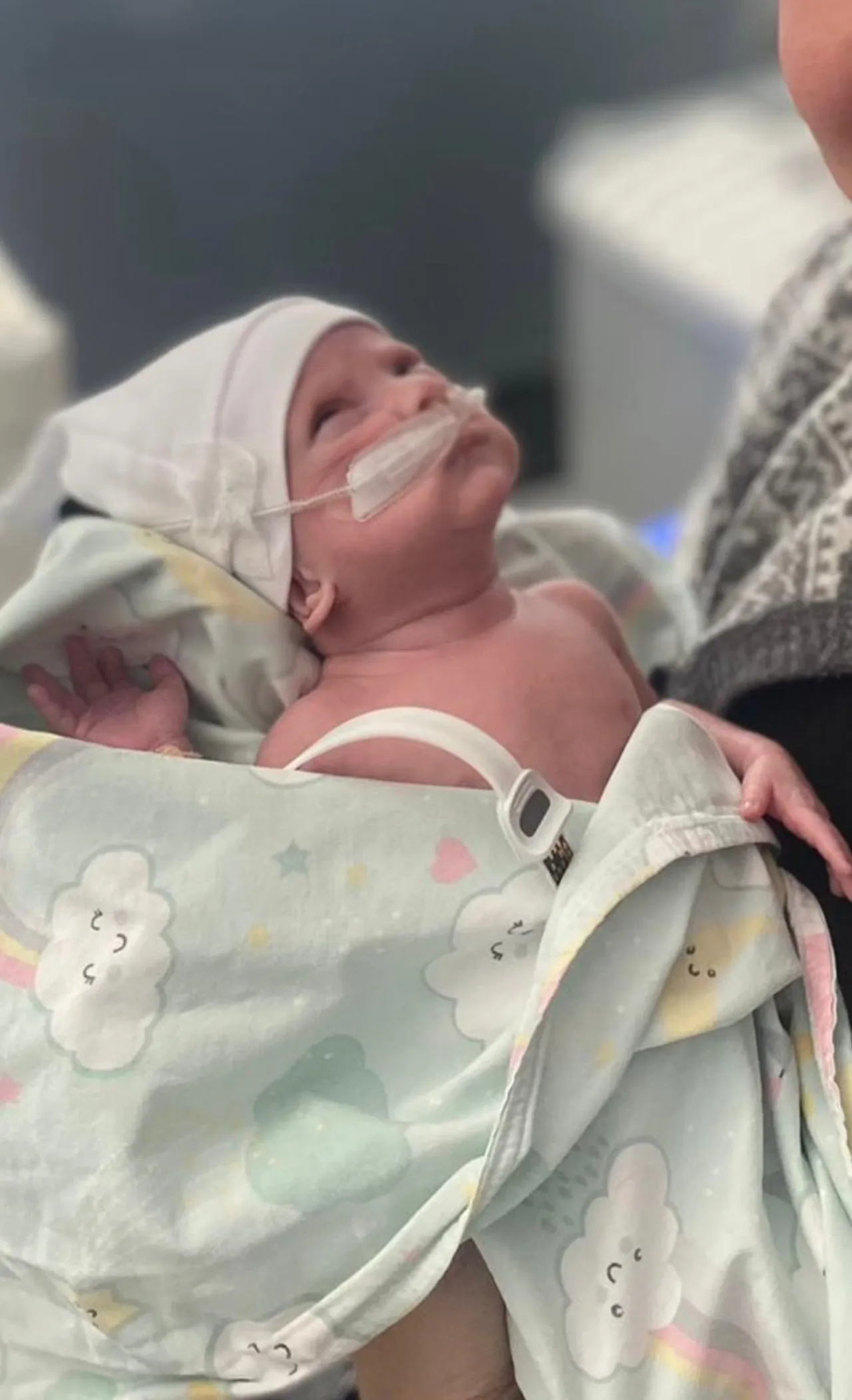 Dünya prematüre günü: Bir avuç doğdu hayata tutundu!