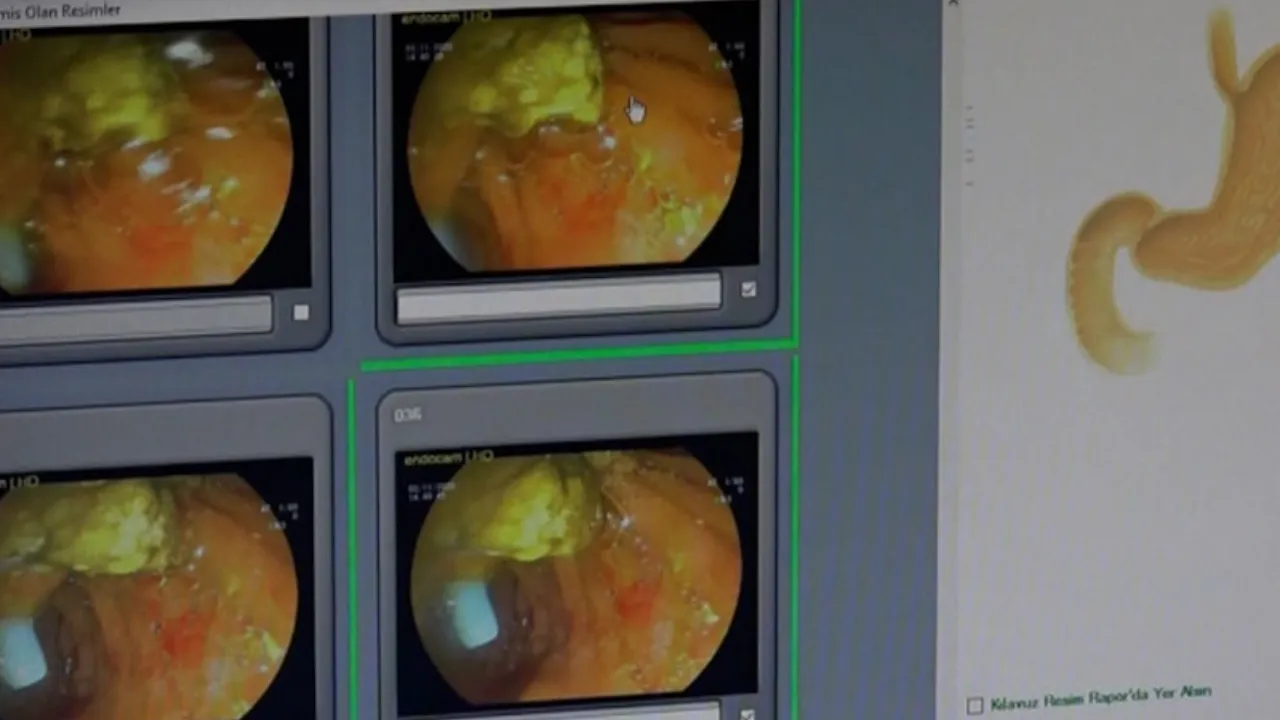 İÇ ORGANLARININ TAMAMI TERS TARAFTA ÇIKTI