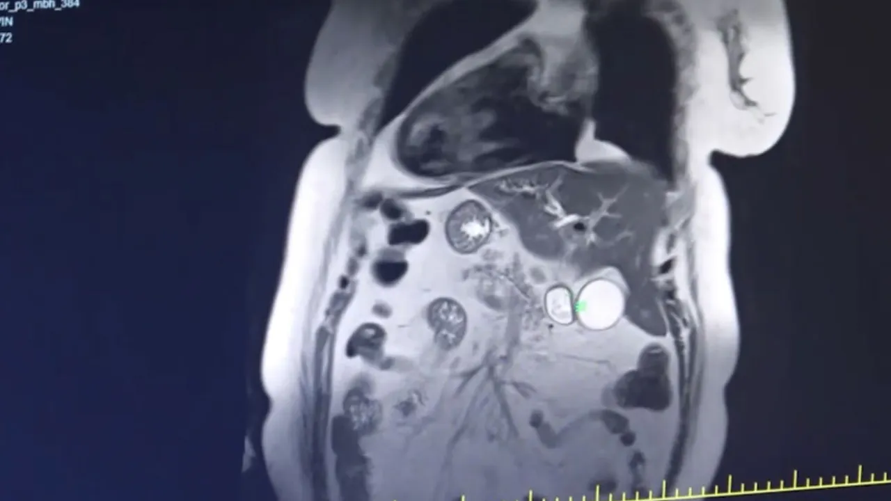 KALBİ DE SAĞDAYMIŞ