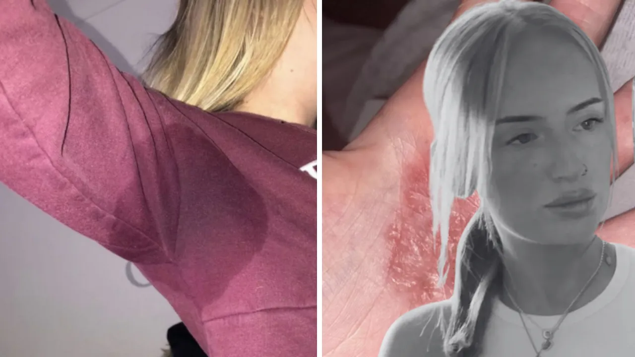 10 yaşındayken fark etti! Bu hastalık hayatını kabusa çevirdi: Dışarı çıkmak istemiyorum