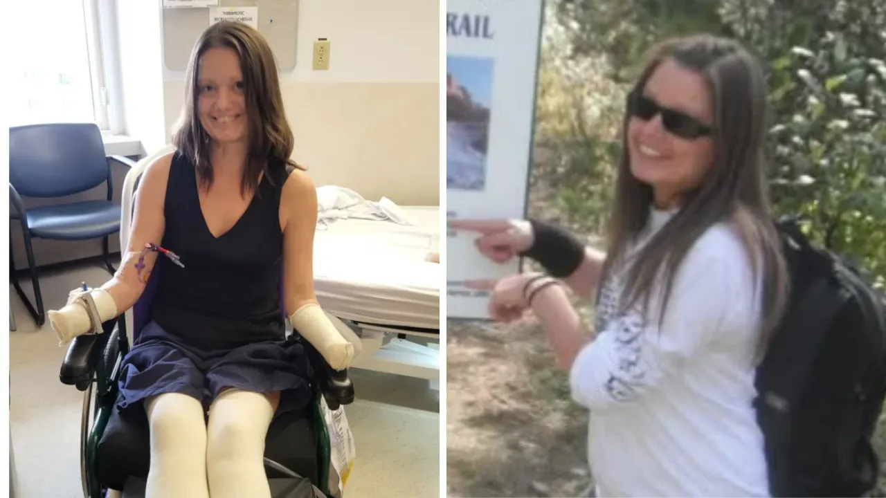 Ağrı şikayetini önemsemedi, acı gerçek yoğun bakımda ortaya çıktı! El ve ayakları ampute edildi