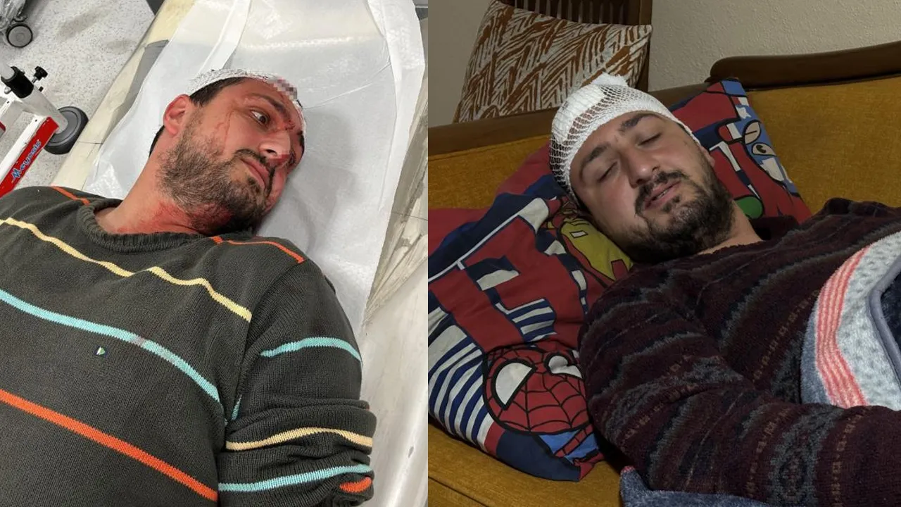 Vicdanları sarsan saldırı! Savunmasız otizmli gence odunla işkence