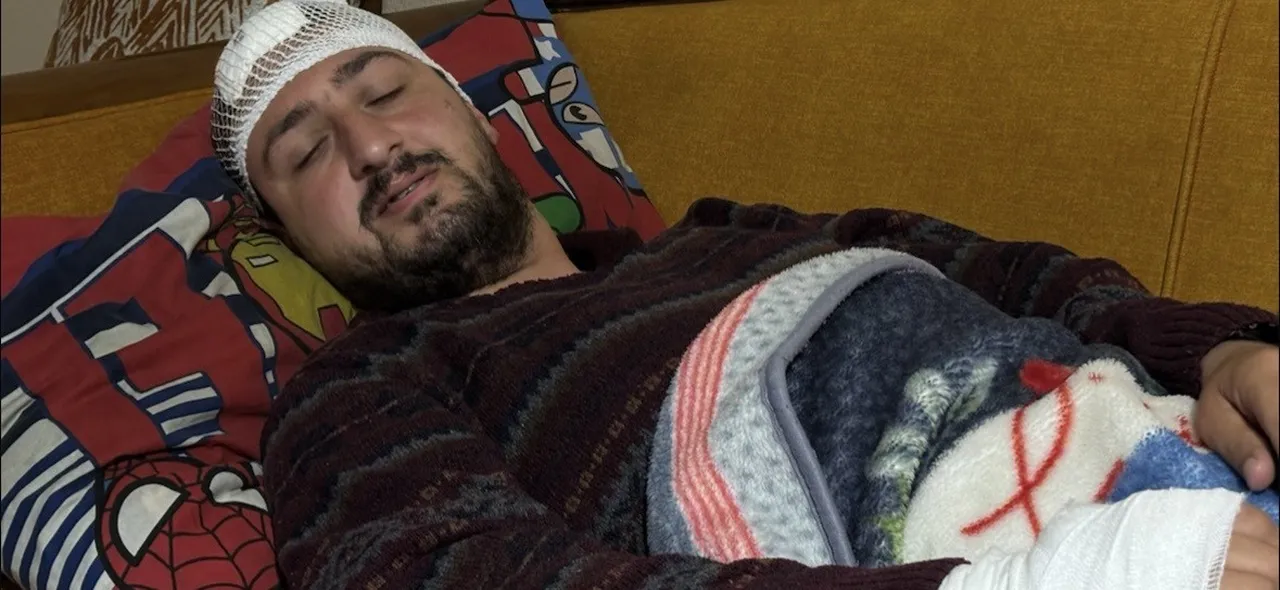 Vicdanları sarsan saldırı! Savunmasız otizmli gence odunla işkence