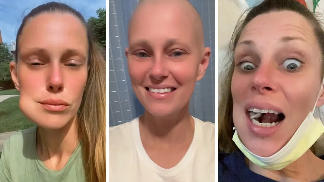 Basit bir apse sandı, 13 kilo verdi! Acı gerçek hastanede ortaya çıktı 