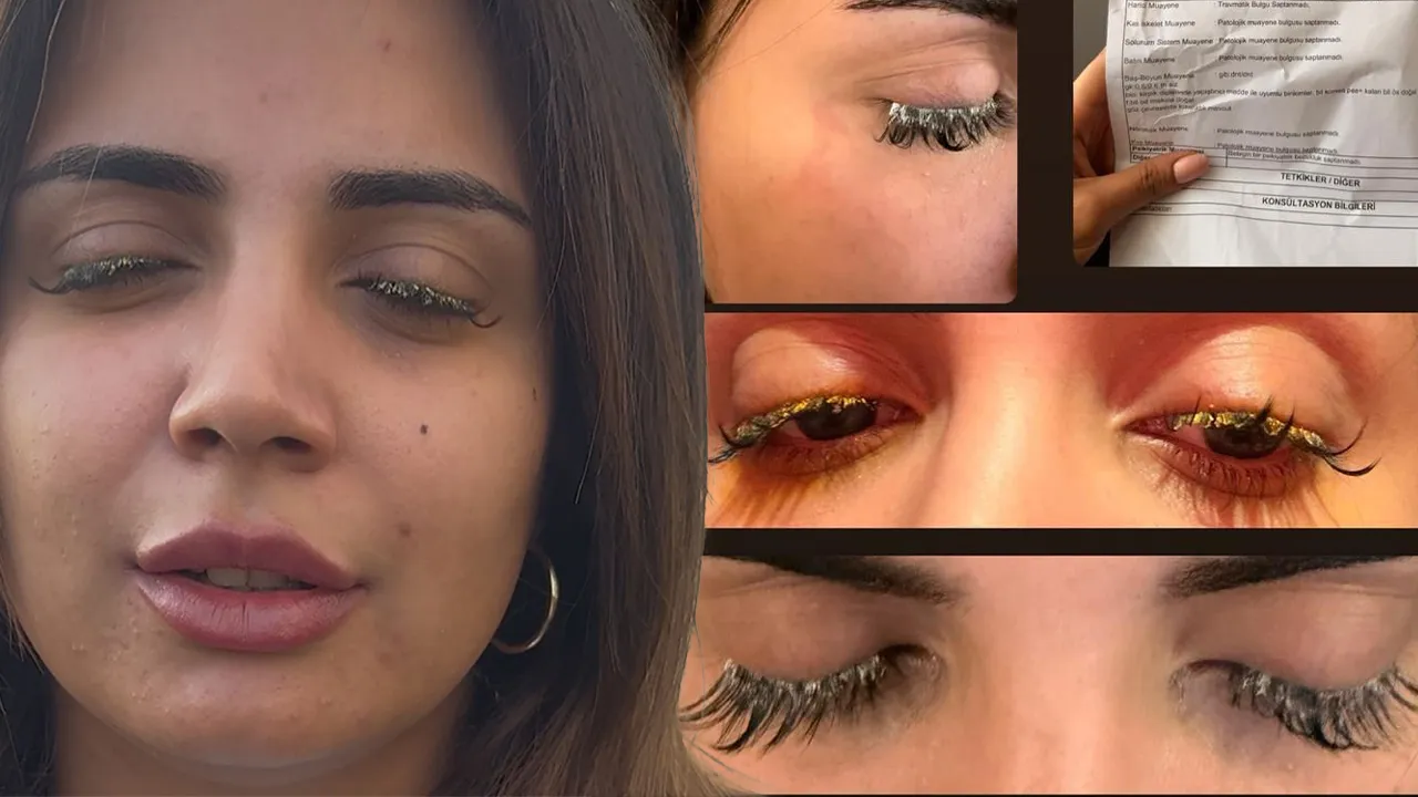 Güzellik merkezinde büyük skandal! Genç kadın az daha kör oluyordu