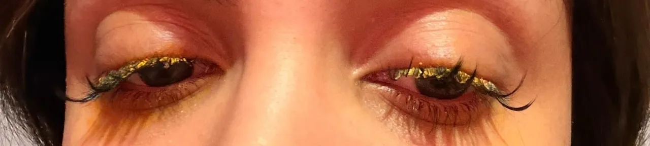 Güzellik merkezinde büyük skandal! Genç kadın az daha kör oluyordu