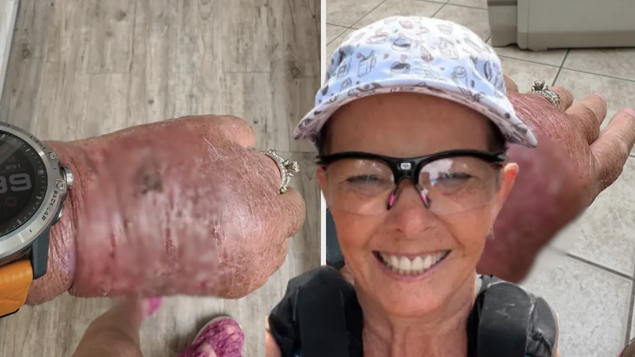 Basit bir kesik dedi, önemsemedi! Bir hafta sonra kabusu yaşadı